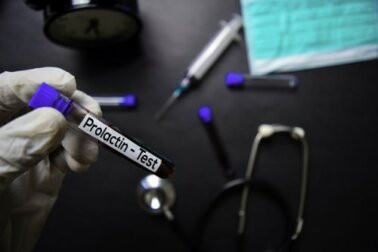 Valores normais de prolactina e por que eles podem ficar alterados