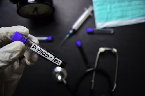 Valores normais de prolactina e por que eles podem ficar alterados