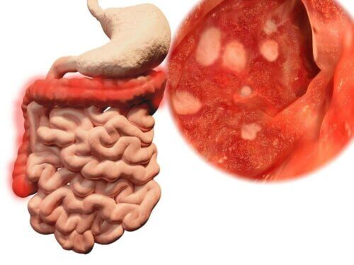 Bactérias do intestino
