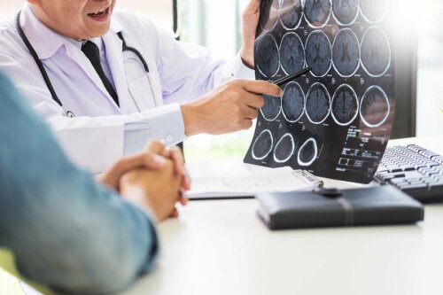 Tomografia cerebral