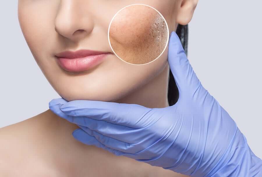 Rejuvenescimento facial