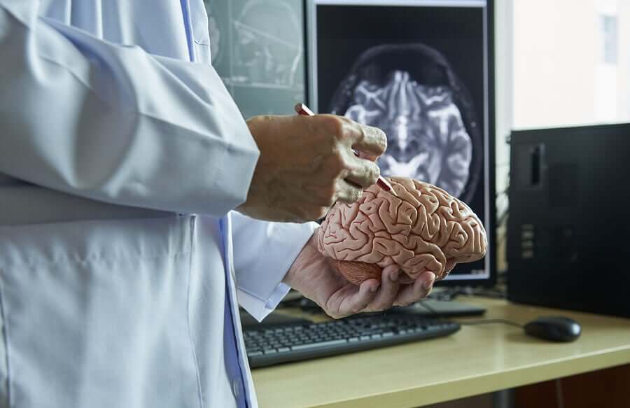 Anatomia do cérebro