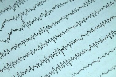 Epilepsia e amamentação