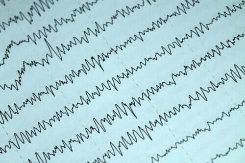 Epilepsia e amamentação