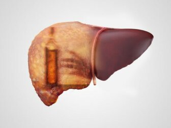Hepatite alcoólica: sintomas, causas e tratamentos