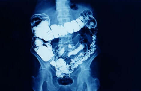 Problemas intestinais