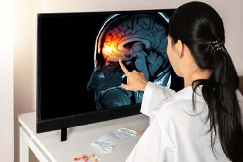 Meninges: o que são e para que servem?