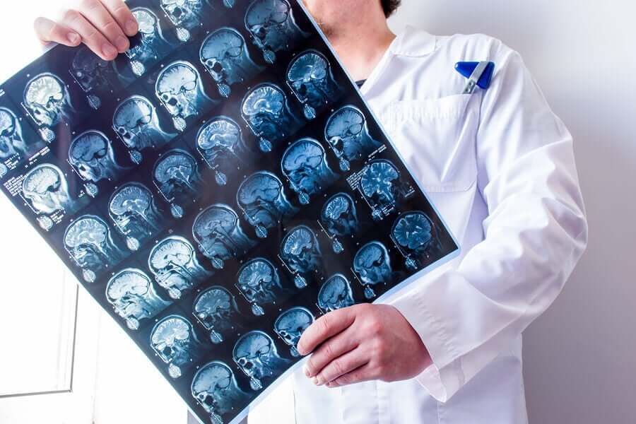 Exame de imagem cerebral