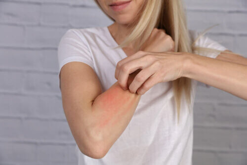 Mulher com alergia no braço