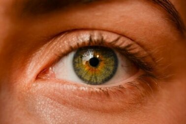 Nevus de conjuntiva: tudo que você precisa saber