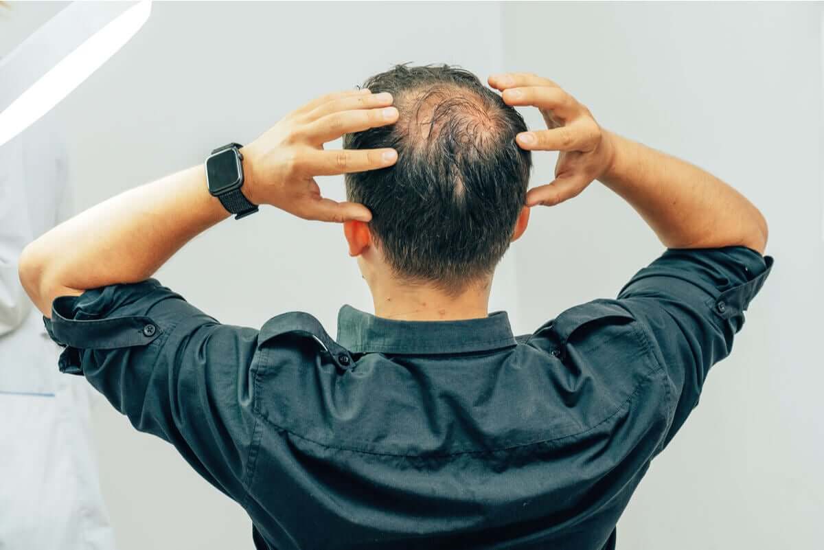 Homem com queda de cabelo