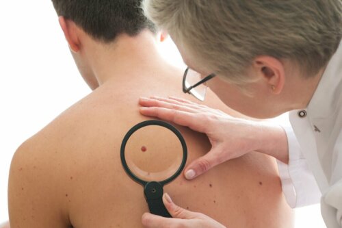 Dermatologista analisando pintas