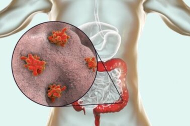 Doenças causadas por protozoários
