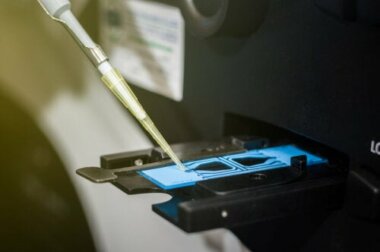 Como interpretar os resultados de um espermograma