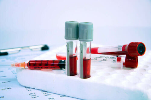 Exame de sangue para detectar a anemia