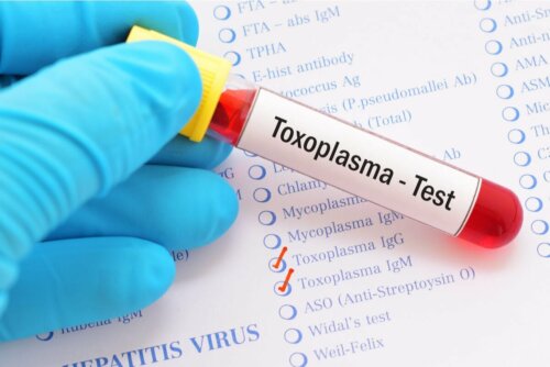 Exame de toxoplasmose