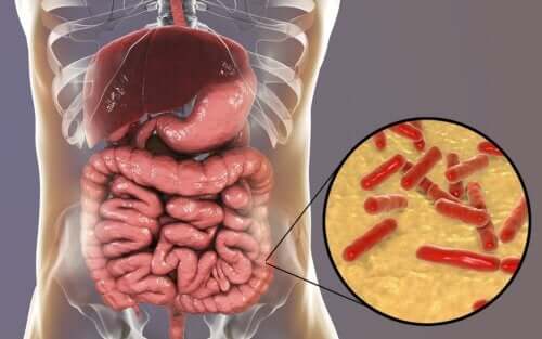 Como saber se a flora intestinal está danificada?