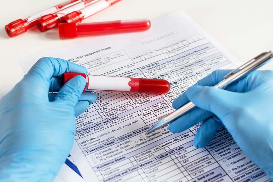 Resultados de exame de sangue
