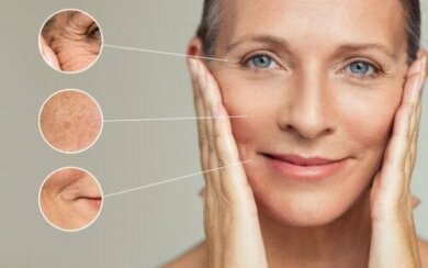 Quais são os diferentes tipos de rugas?