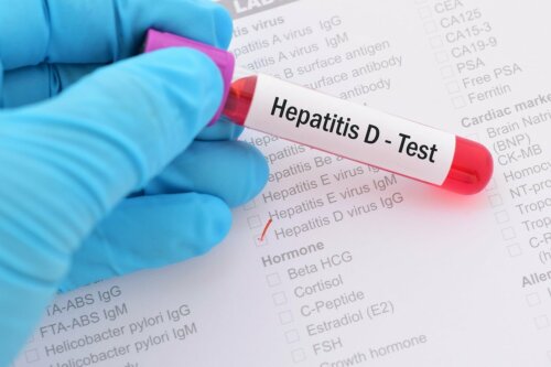 Exame de hepatite D