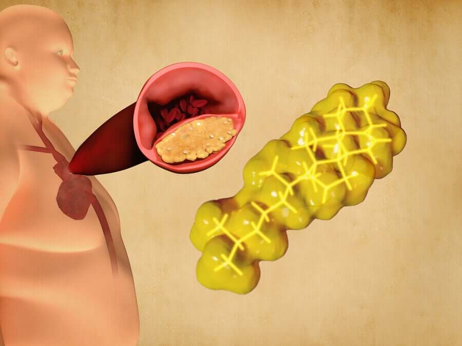 Triglicerídeos no sangue
