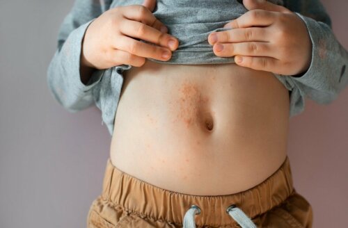 Alergia na pele da barriga