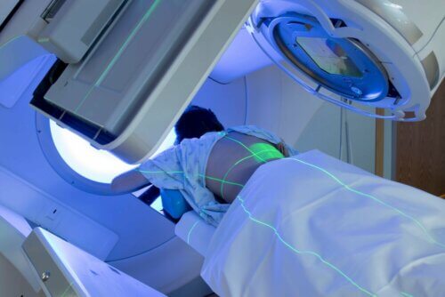 Paciente fazendo radioterapia