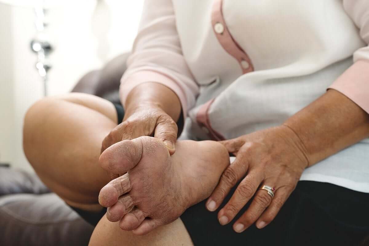 Paciente com pé diabético