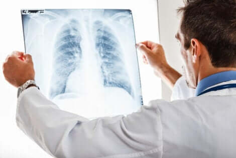 Controle dos pulmões com radiografia