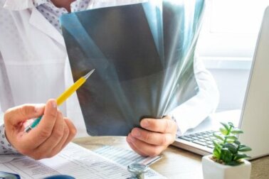 Edema ósseo: tudo que você precisa saber