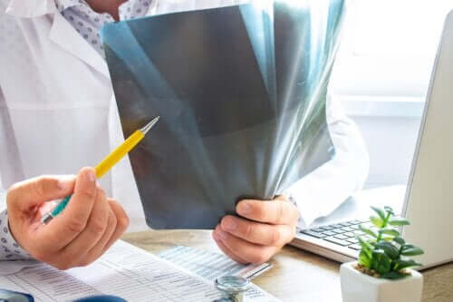 Edema ósseo: tudo que você precisa saber