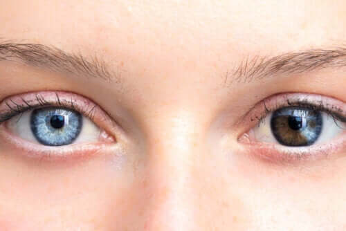 As mudanças na cor dos olhos são preocupantes?