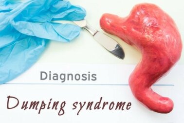 O que é a síndrome de dumping?
