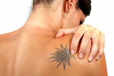 É possível remover tatuagens?