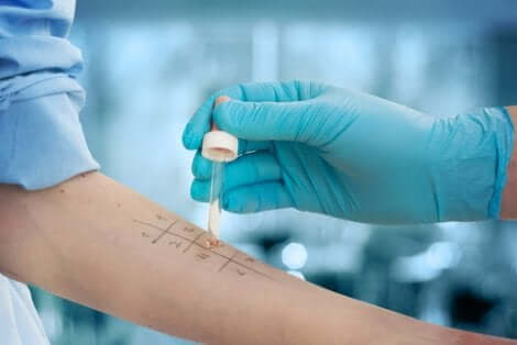 Testes para alergia