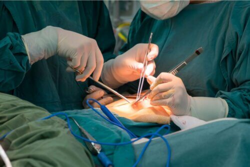 Cirurgia cardíaca