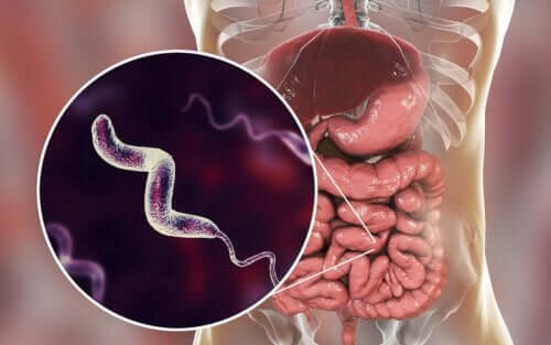 Infecções por Campylobacter: tudo que você precisa saber