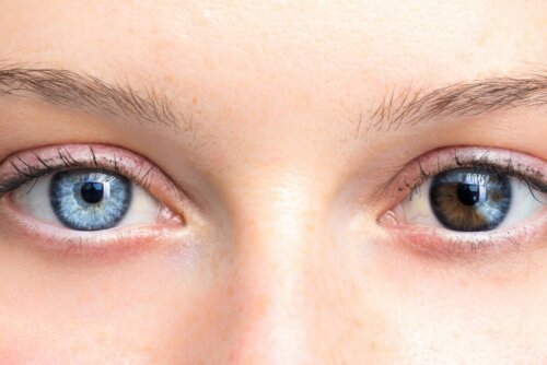 Olhos de cores diferentes