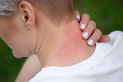 Por que os mosquitos picam?