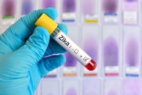 Exame para detectar zika virus