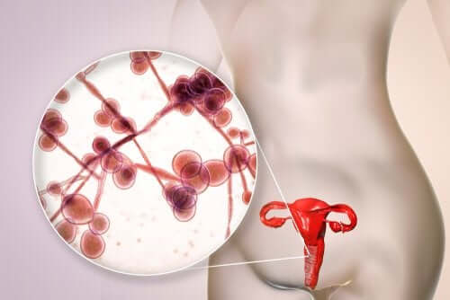 Cetoconazol: indicações e contraindicações