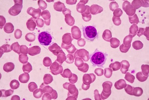 Células cancerígenas no sangue