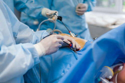 Cirurgia de ostomia