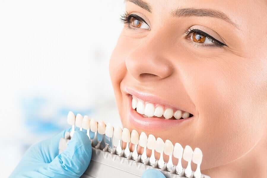 Clareamento dental