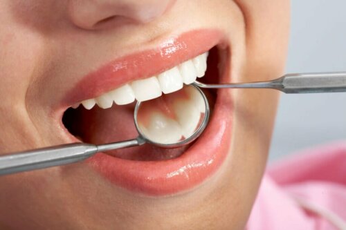Dentista examinando dentes