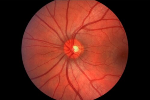 Exame ocular
