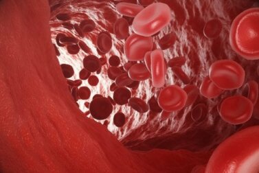 O que é a hipoxemia arterial?