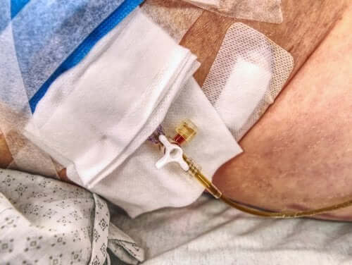 Recomendações para pessoas ostomizadas