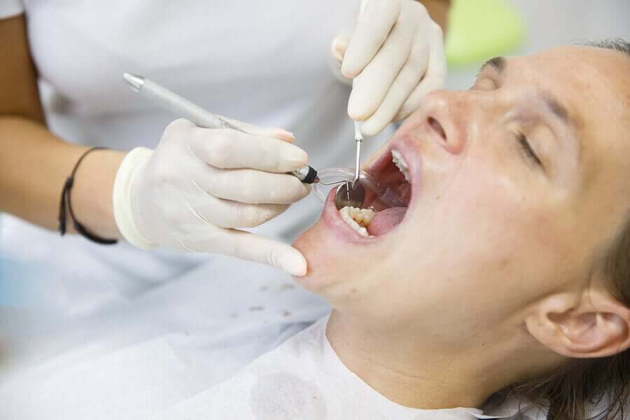Colocar facetas dentárias