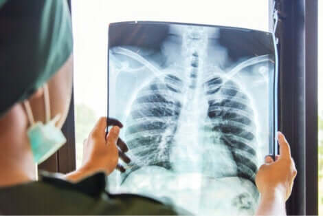 Radiografia do pulmão